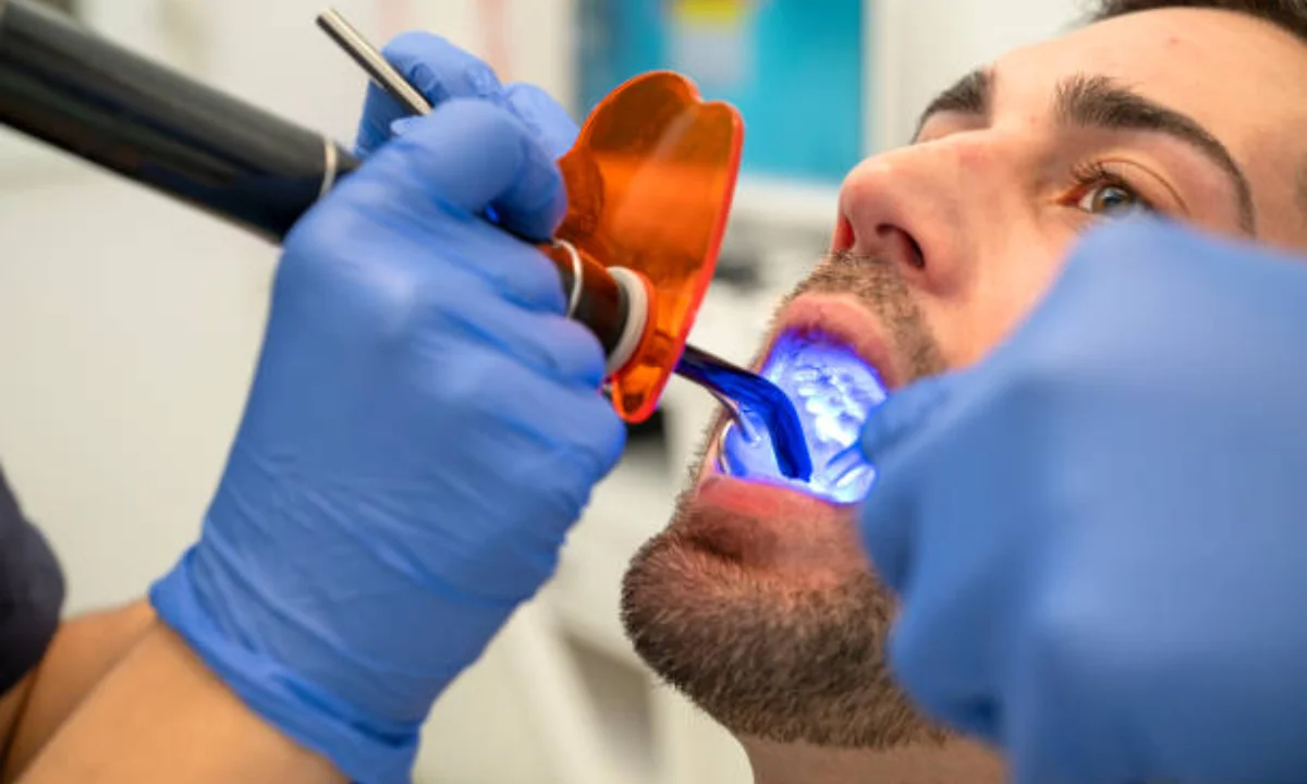 Root Canal Treatment Meerut