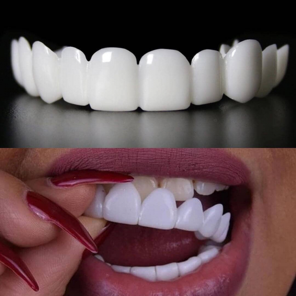 Teeth whitening Vadodara