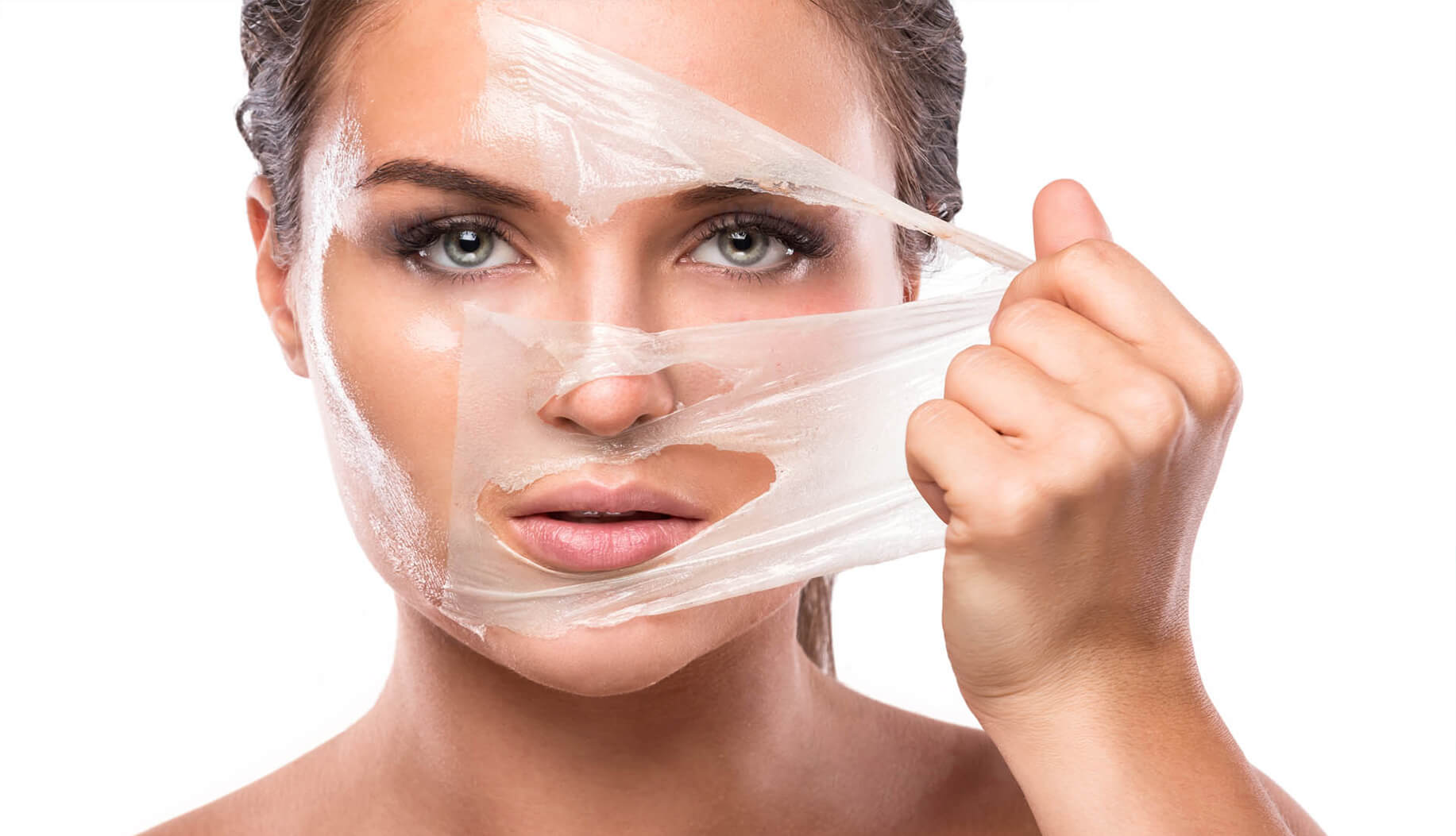 Chemical Peel