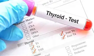 Thyroid testing services at pathology lab - T3, T4, TSH tests in Agra