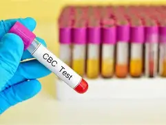 CBC test at pathology lab - complete blood count in Agra