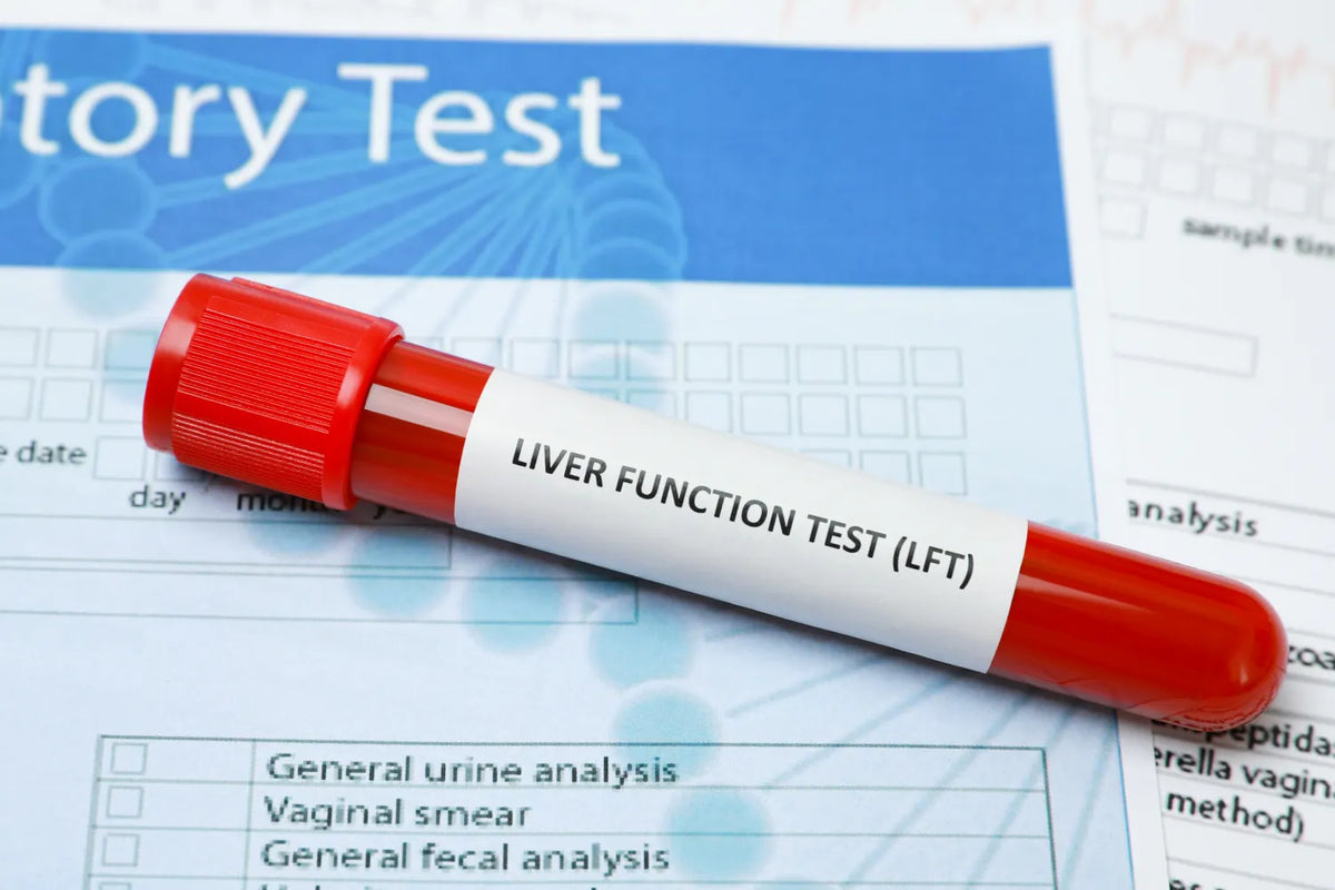 Liver function test at pathology lab - liver enzyme panel in Agra