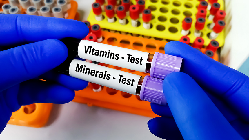Vitamin tests at pathology lab - Vitamin D, B12, Iron tests in Agra