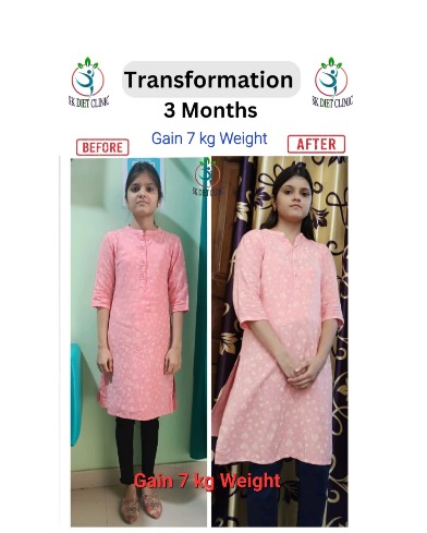 3 Months Gain 7kg Weight transformation at SK Diet Clinic