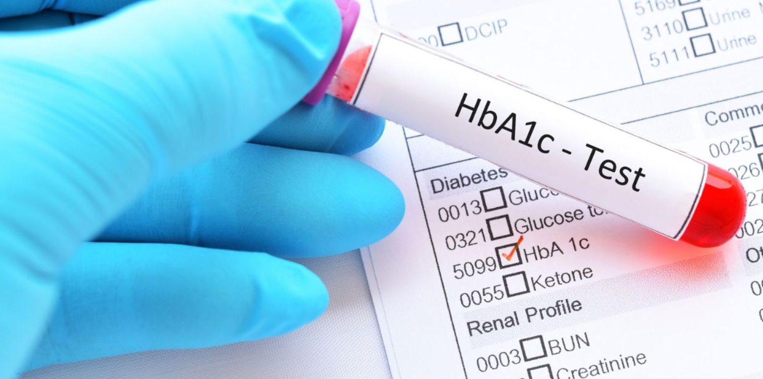 Diabetes HbA1c Sample Collection Indore