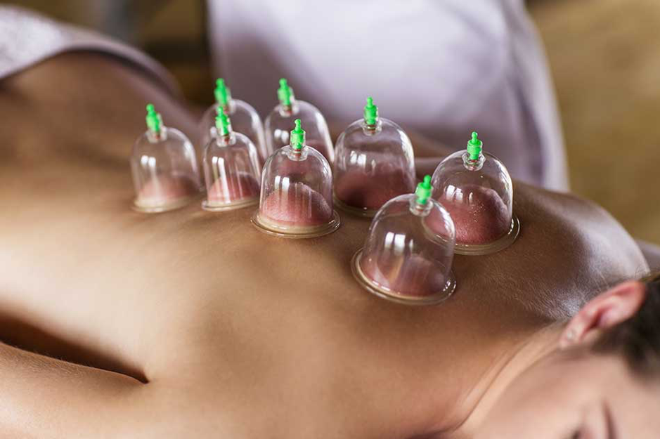 Cupping and Hotstone Therapy Thane - Ayurvedic Wellness