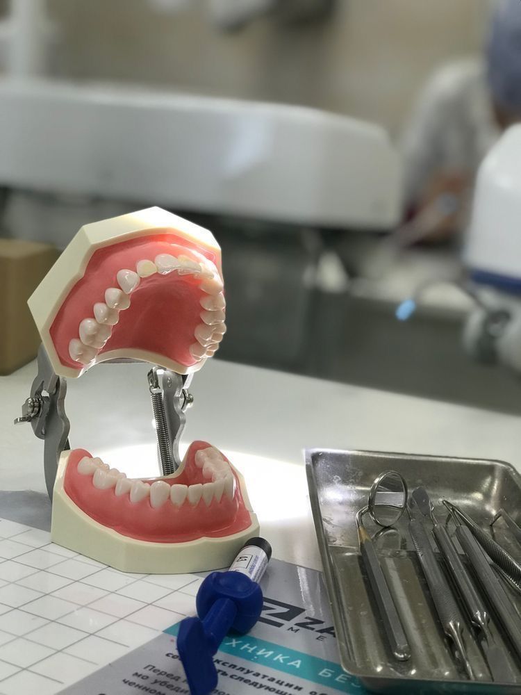 Smiline Dental teeth whitening result Saket South Delhi